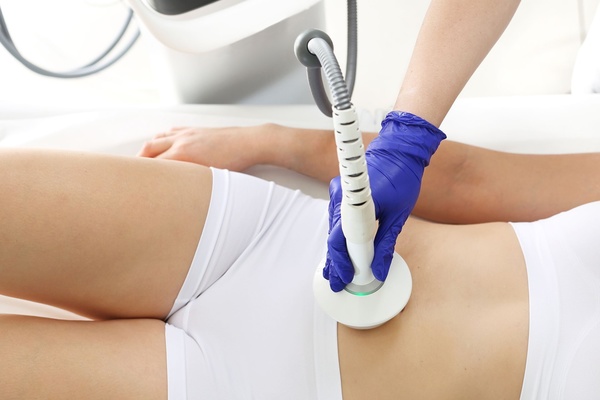 HIFU skoncentrowane ultradźwięki